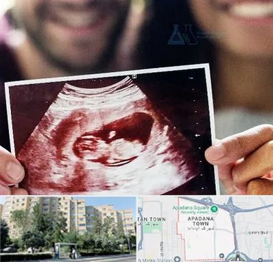 غربال گری در آپادانا