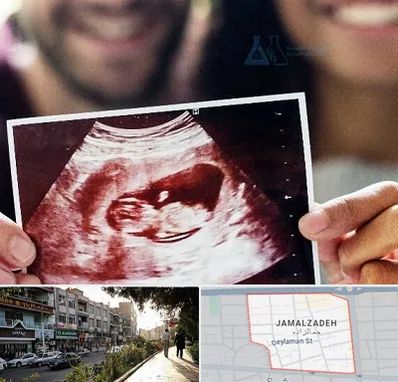 غربال گری در خیابان جمالزاده