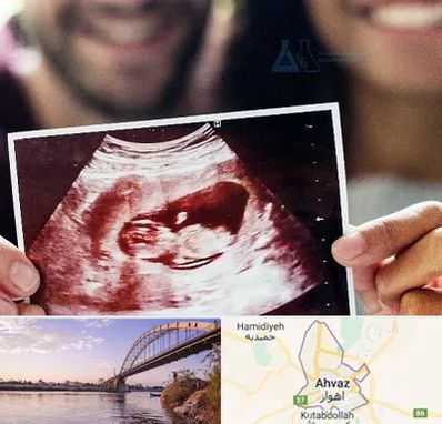 غربال گری در اهواز