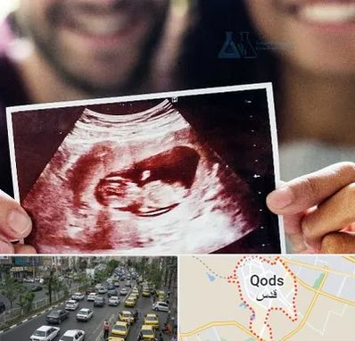 غربال گری در شهر قدس