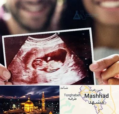 غربال گری در مشهد