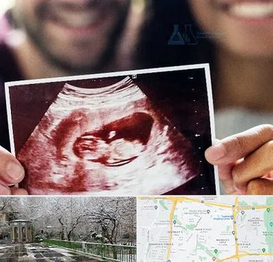 غربال گری در باغ فیض