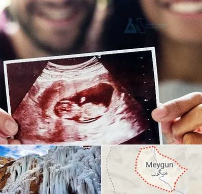 غربال گری در میگون