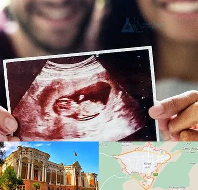 غربال گری در خوی