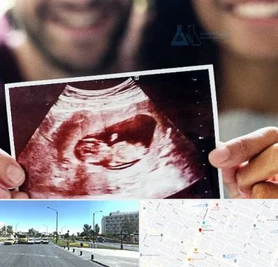 غربال گری در بلوار کلاهدوز مشهد