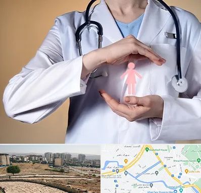 لابیاپلاستی در کوی وحدت شیراز