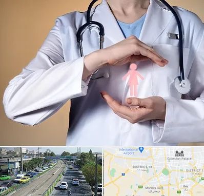 لابیاپلاستی در جنوب تهران 