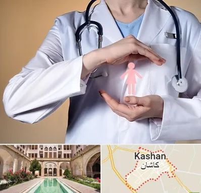 لابیاپلاستی در کاشان