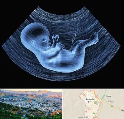 دکتر متخصص غربال گری در سنندج