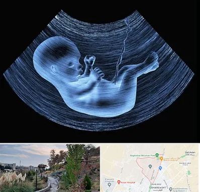 دکتر متخصص غربال گری در باغستان کرج