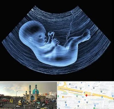 دکتر متخصص غربال گری در رسالت