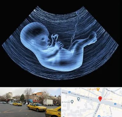 دکتر متخصص غربال گری در شهناز تبریز