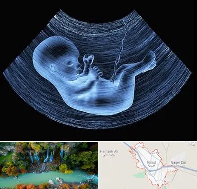 دکتر متخصص غربال گری در دورود