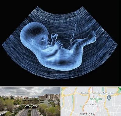 دکتر متخصص غربال گری در یوسف آباد 