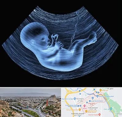 دکتر متخصص غربال گری در معالی آباد شیراز