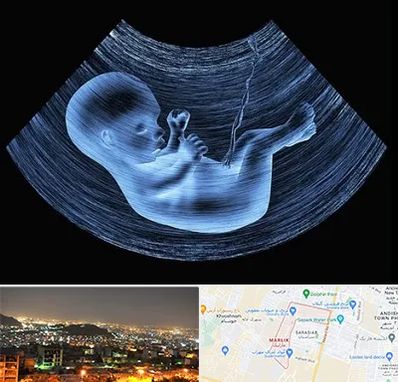 دکتر متخصص غربال گری در مارلیک کرج