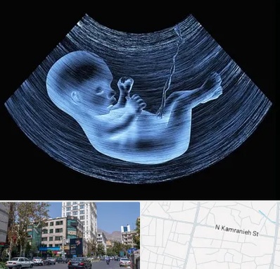 دکتر متخصص غربال گری در کامرانیه