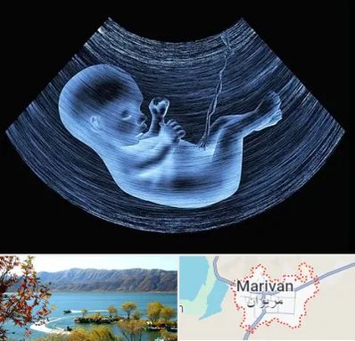دکتر متخصص غربال گری در مریوان