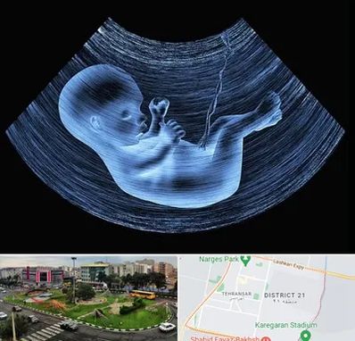 دکتر متخصص غربال گری در تهرانسر 