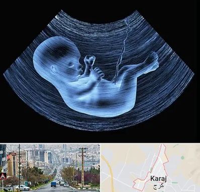 دکتر متخصص غربال گری در گوهردشت کرج 