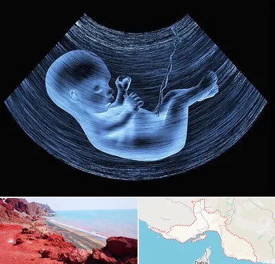 دکتر متخصص غربال گری در هرمزگان
