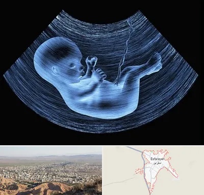 دکتر متخصص غربال گری در اسفراین