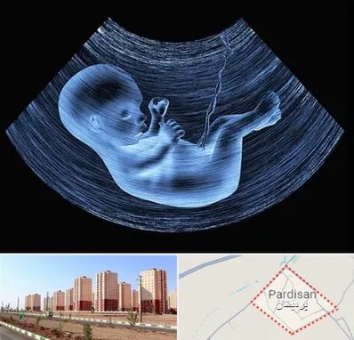 دکتر متخصص غربال گری در پردیسان قم