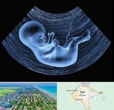 دکتر متخصص غربال گری در ساری