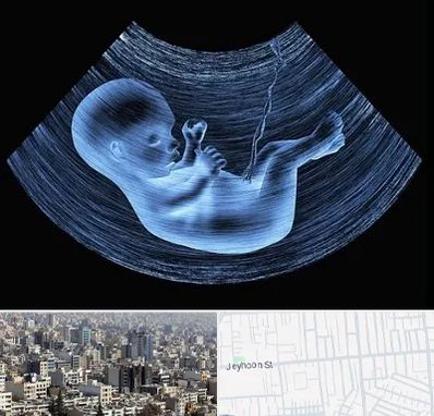 دکتر متخصص غربال گری در جیحون