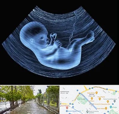 دکتر متخصص غربال گری در خیابان ارم شیراز