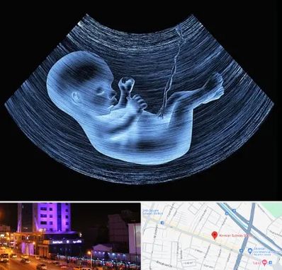 دکتر متخصص غربال گری در آبرسان تبریز