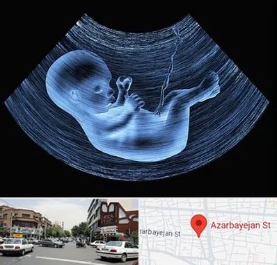 دکتر متخصص غربال گری در خیابان آذربایجان