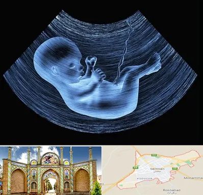 دکتر متخصص غربال گری در سمنان