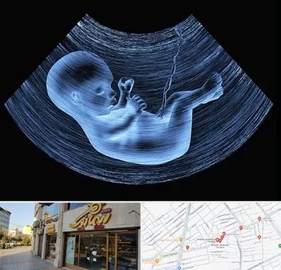 دکتر متخصص غربال گری در عطاران قم