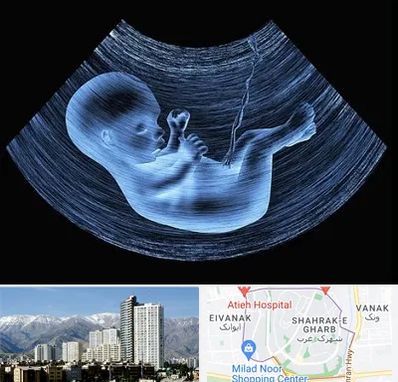 دکتر متخصص غربال گری در شهرک غرب 