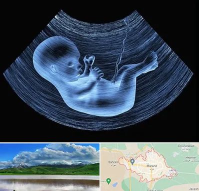 دکتر متخصص غربال گری در مرند