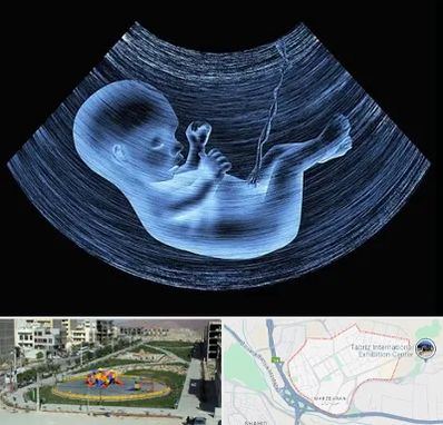 دکتر متخصص غربال گری در مرزداران تبریز