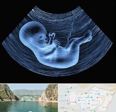 دکتر متخصص غربال گری در ایلام