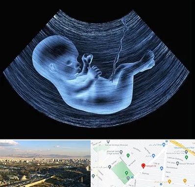 دکتر متخصص غربال گری در هنگام