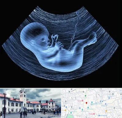 دکتر متخصص غربال گری در میدان شهرداری رشت