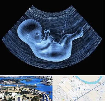 دکتر متخصص غربال گری در کوروش اهواز