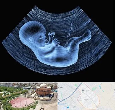 دکتر متخصص غربال گری در گلستان اسلامشهر