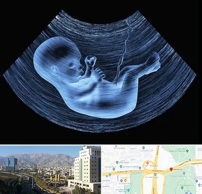 دکتر متخصص غربال گری در حقانی