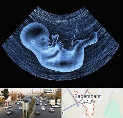 دکتر متخصص غربال گری در باقرشهر