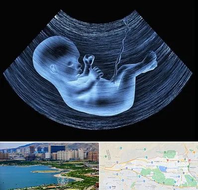 دکتر متخصص غربال گری در منطقه 22 تهران