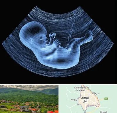 دکتر متخصص غربال گری در آمل