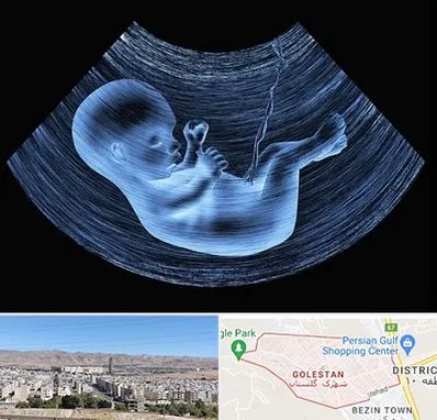 دکتر متخصص غربال گری در شهرک گلستان شیراز