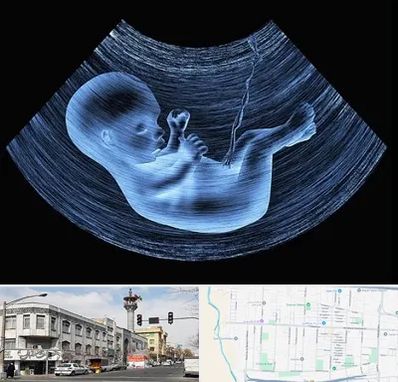 دکتر متخصص غربال گری در 17شهریور