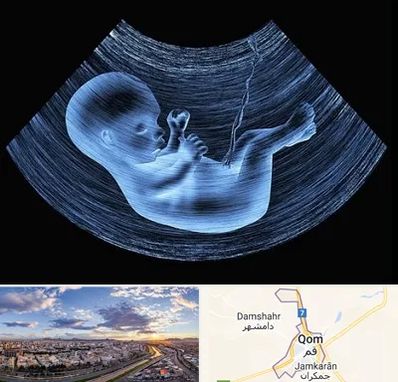 دکتر متخصص غربال گری در قم