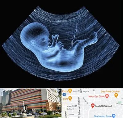 دکتر متخصص غربال گری در سهروردی 